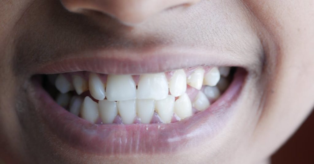 Close-up image of a person's smile highlighting teeth and lips, vibrant and cheerful.